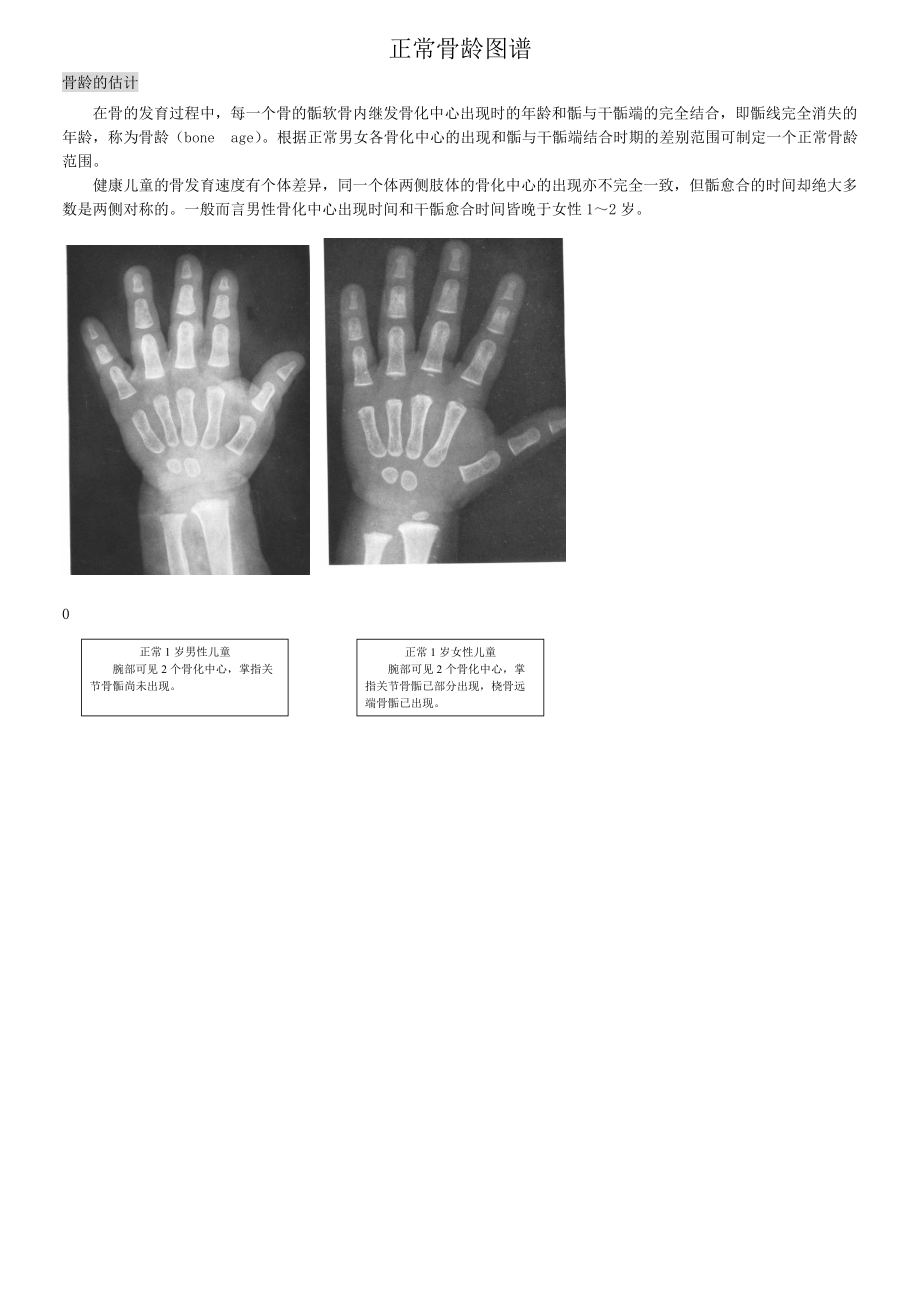 骨龄之对照标准经典实用