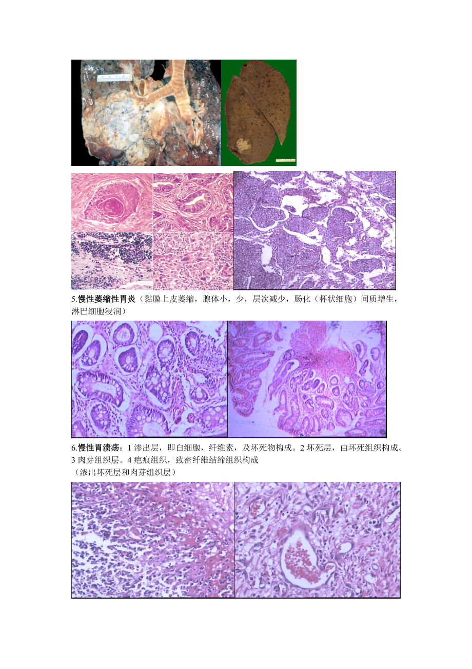 病理实验切片图片整理第二部分