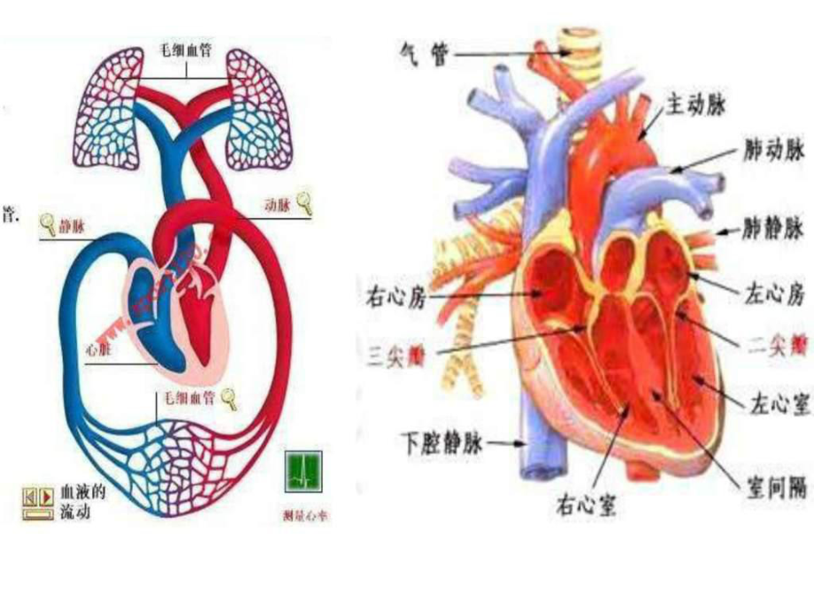 肺心病图解图片