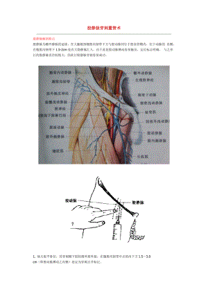 股静脉穿刺置管术