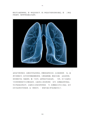 如何判断肺结节是良性还是恶性？