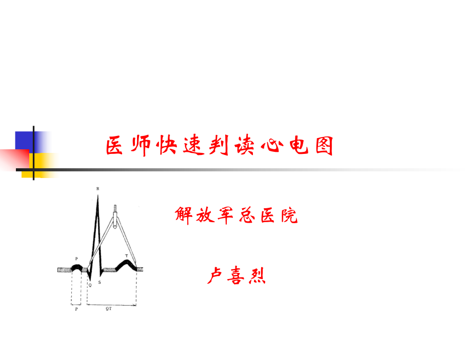 医生快速判读心电图_第1页