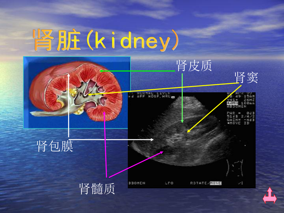 肾脏解剖肾积水肾囊肿的超声诊断学