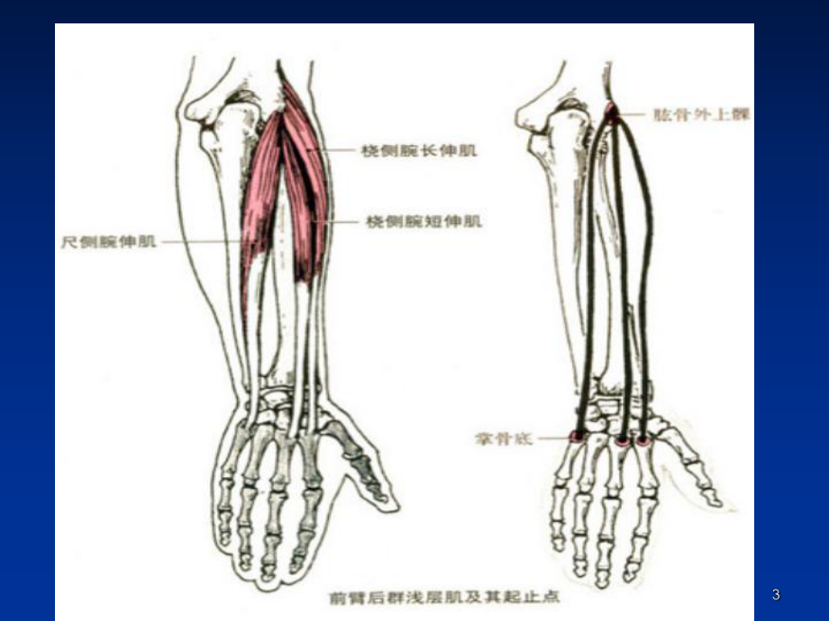 肱骨髁轴线图示图片