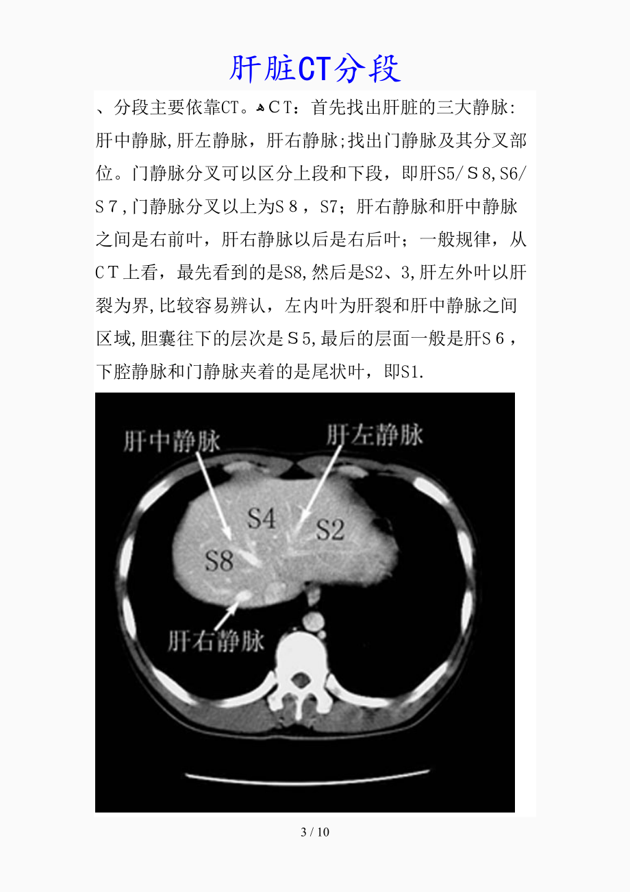 肝脏断层解剖分段图片