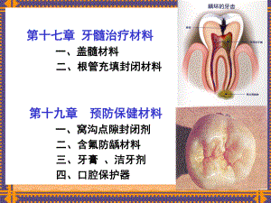 口腔材料学：第十七章牙髓治疗材料