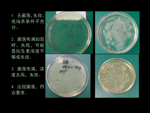 质粒转化大肠杆菌实验经典实用