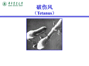 动物传染病学：破伤风（Tetanus）