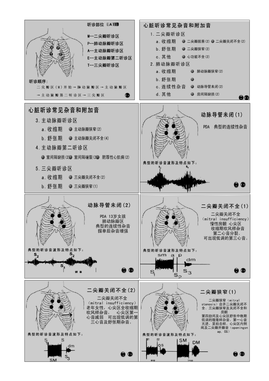 心臟聽診要點烏賊元元_第1頁