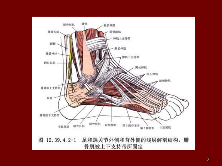 腓骨肌腱滑脱图片图片