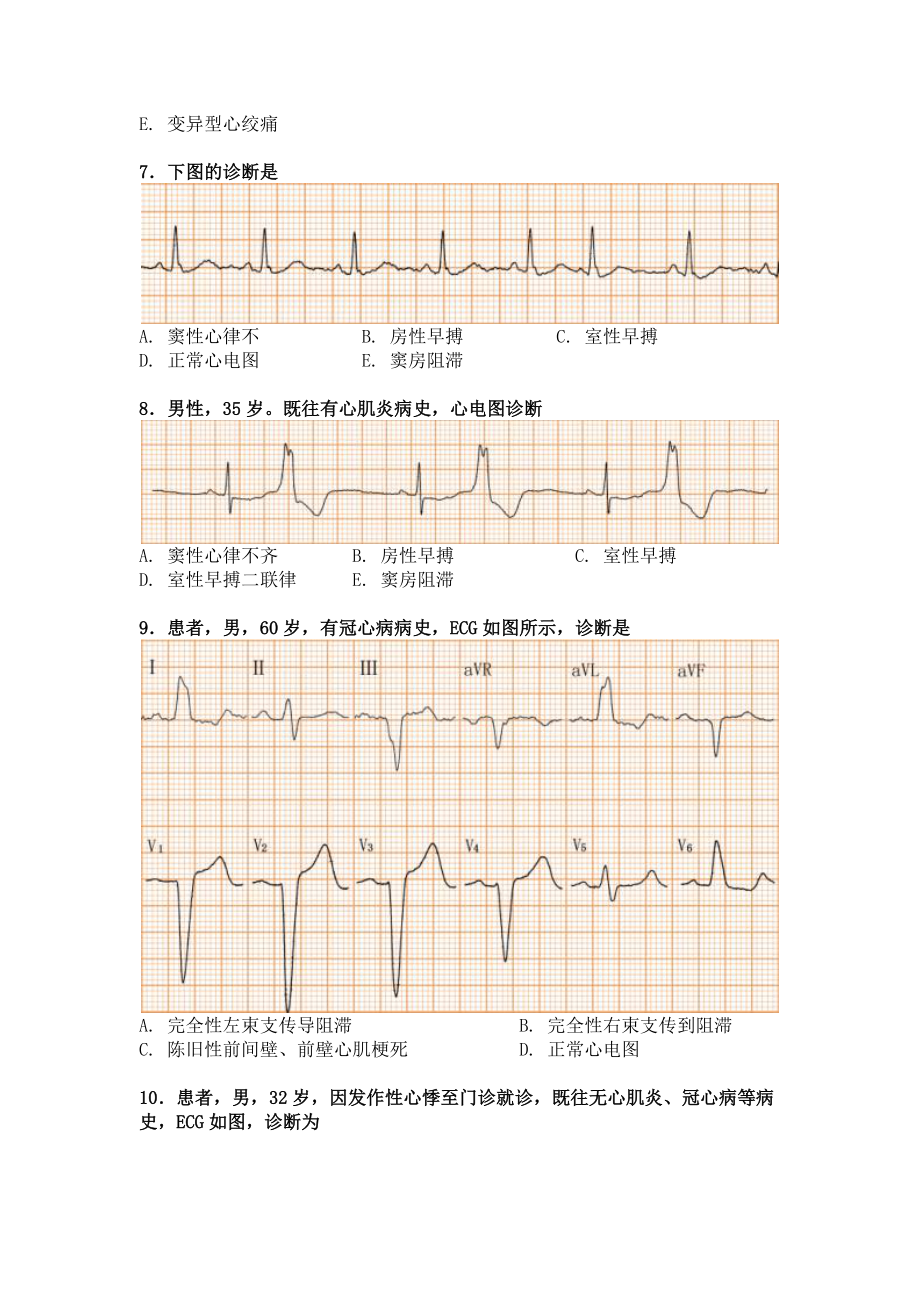 心电图常考题图片