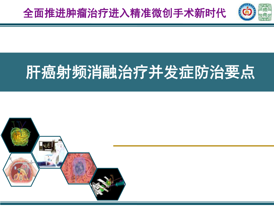 醫(yī)學(xué)交流課件：肝癌射頻消融治療并發(fā)癥防治要點_第1頁