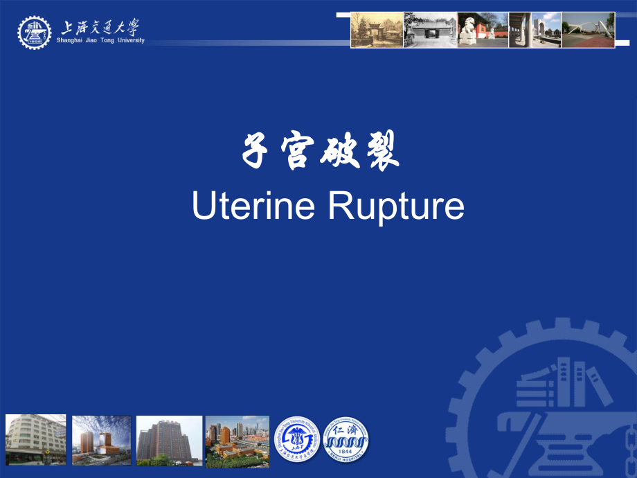 產(chǎn)科學(xué)英文課件：17 子宮破裂 rupture of uterus_第1頁(yè)