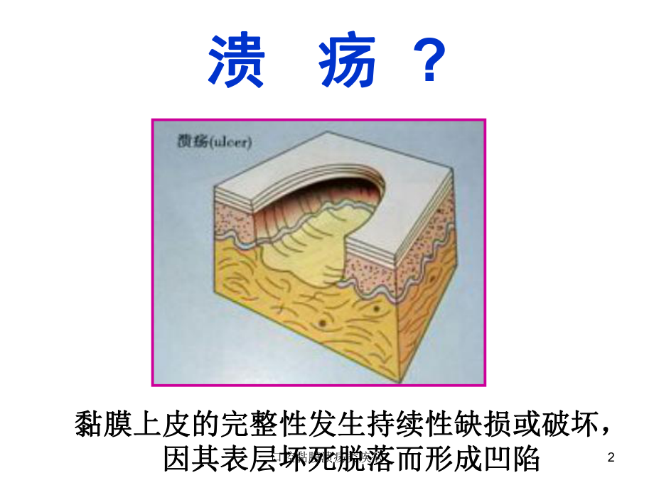 不同类型口腔溃疡图解图片