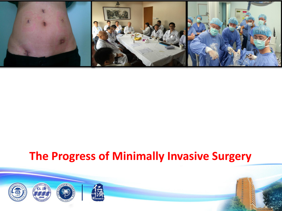 外科学-总论英文课件：The Progress of Minimally Invasive Surgery_第1页