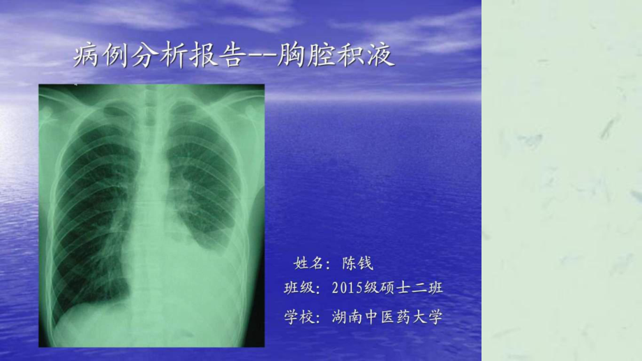 胸腔积液病例分析课件_第1页
