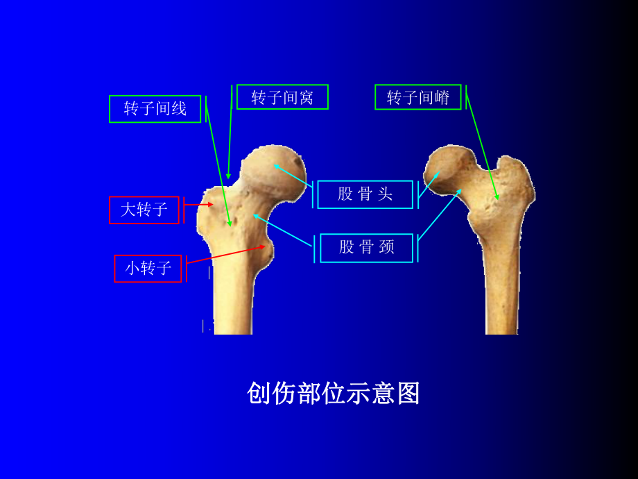 右股骨远端图片