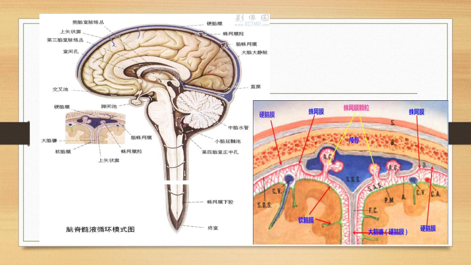 蛛网膜下腔出血的生理解剖及中医病因病机