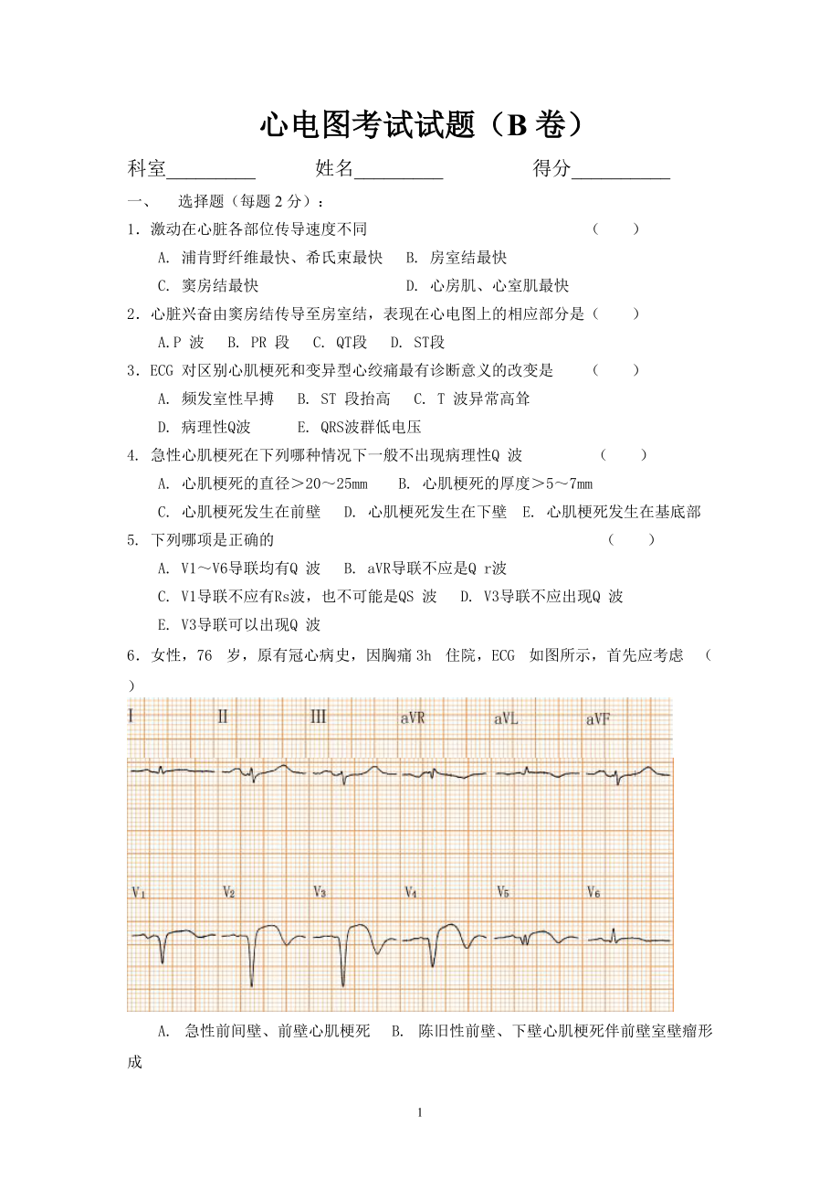 心电图常考题图片