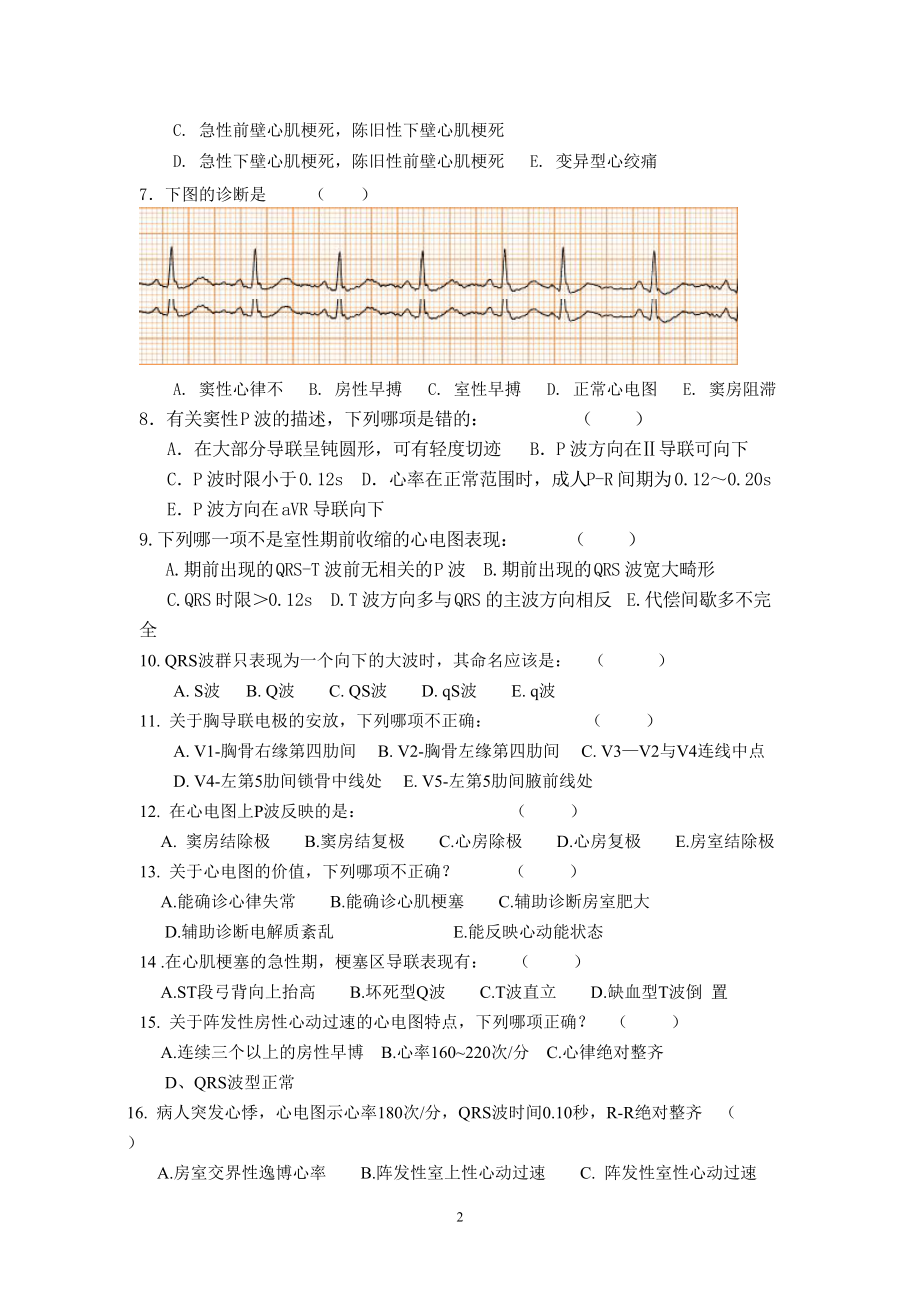 心电图常考题图片