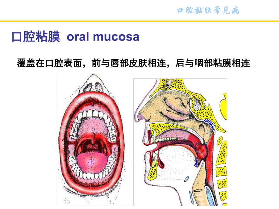 口腔粘膜病ppt