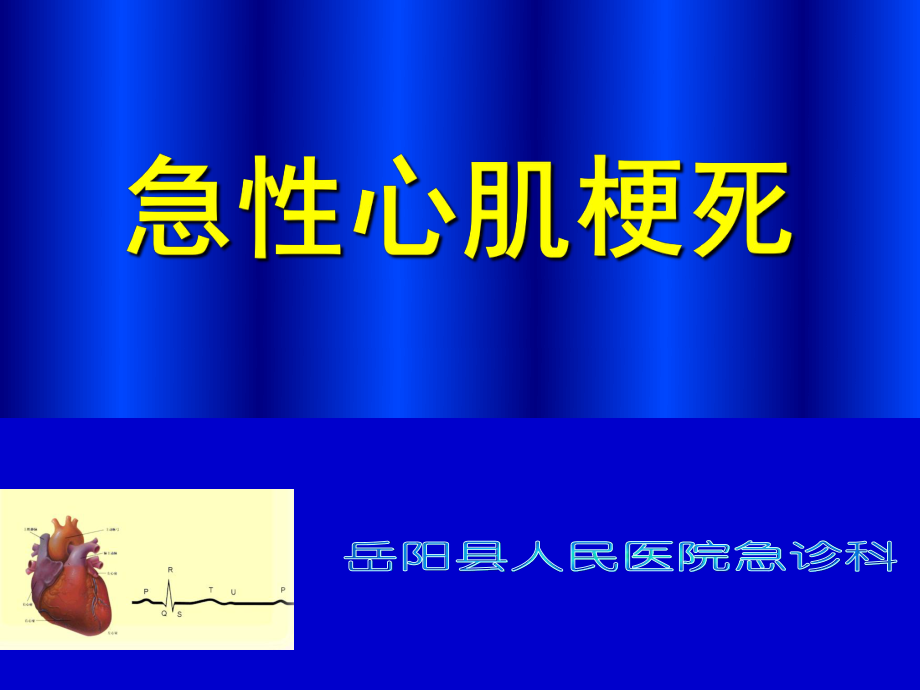 《急性心肌梗死》優(yōu)質(zhì)課件_第1頁