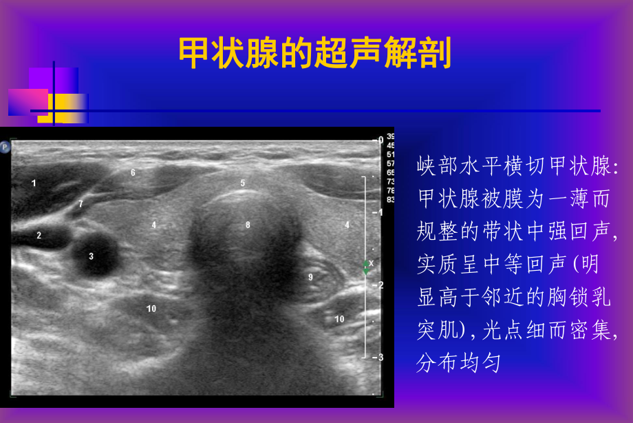 甲狀腺超聲檢查pt課件