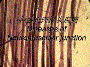 神经病学：神经-肌肉接头疾病