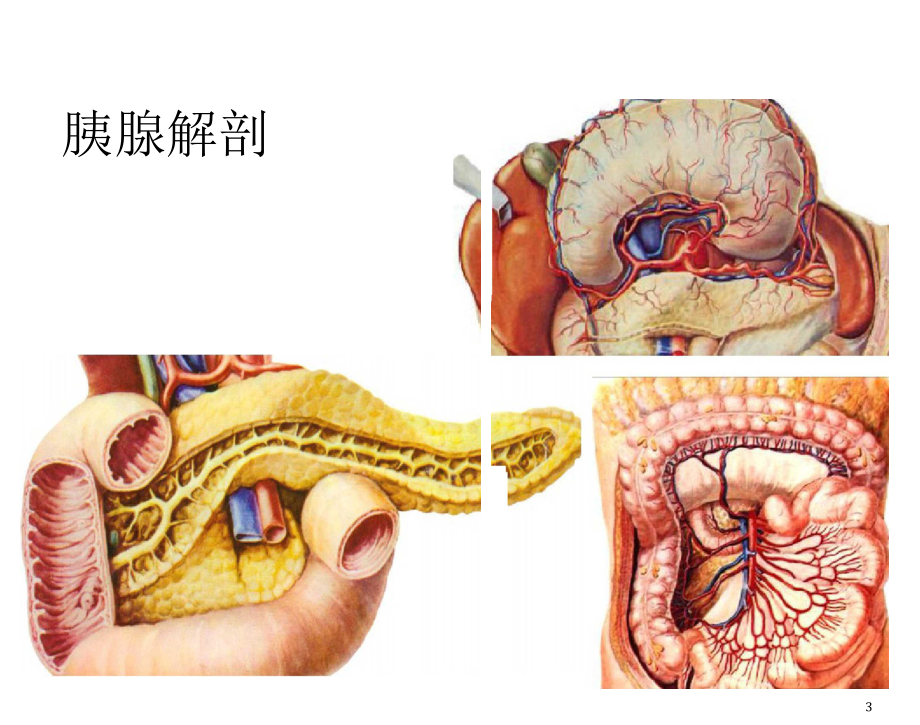 胰腺癌教学课件