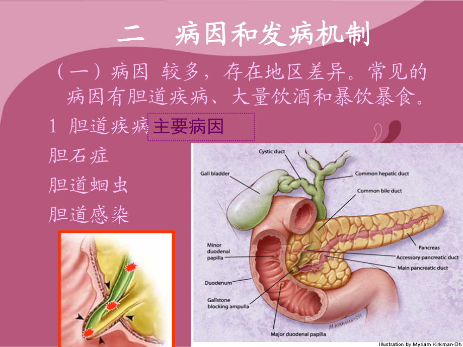 急性胰腺炎讲课