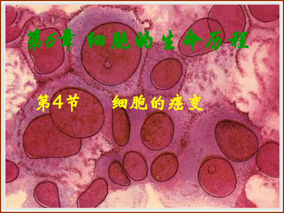 高中生物《第六章 第四節(jié) 細胞的癌變》課件3 新人教版必修1_第1頁