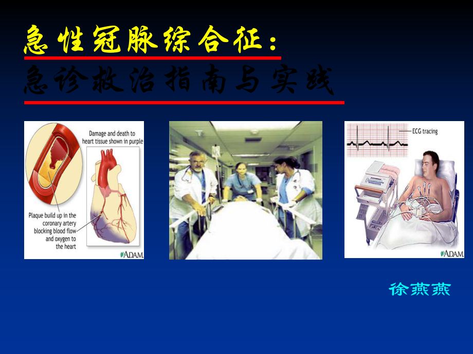 acs急诊指南与实践_第1页