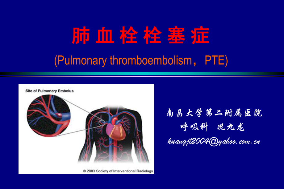 医学pt内科学肺栓塞教案_第1页