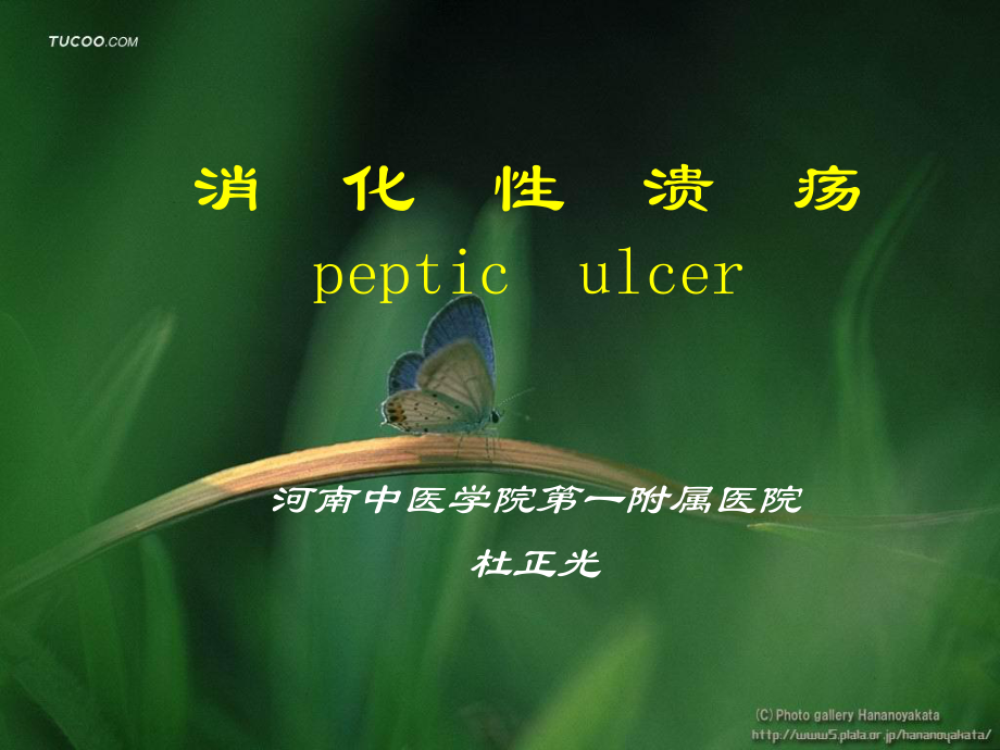 消化溃疡pepticulcer_第1页