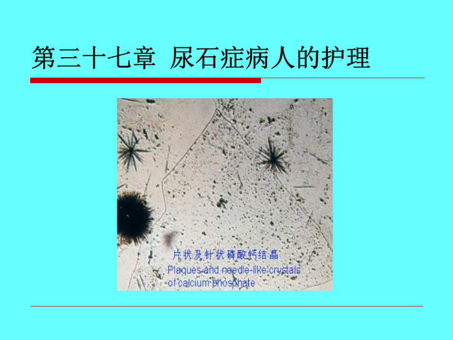 尿石症病人的护理课件.ppt_第1页