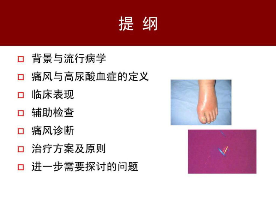 最新中国痛风临床诊治指南精选PPT文档_第1页