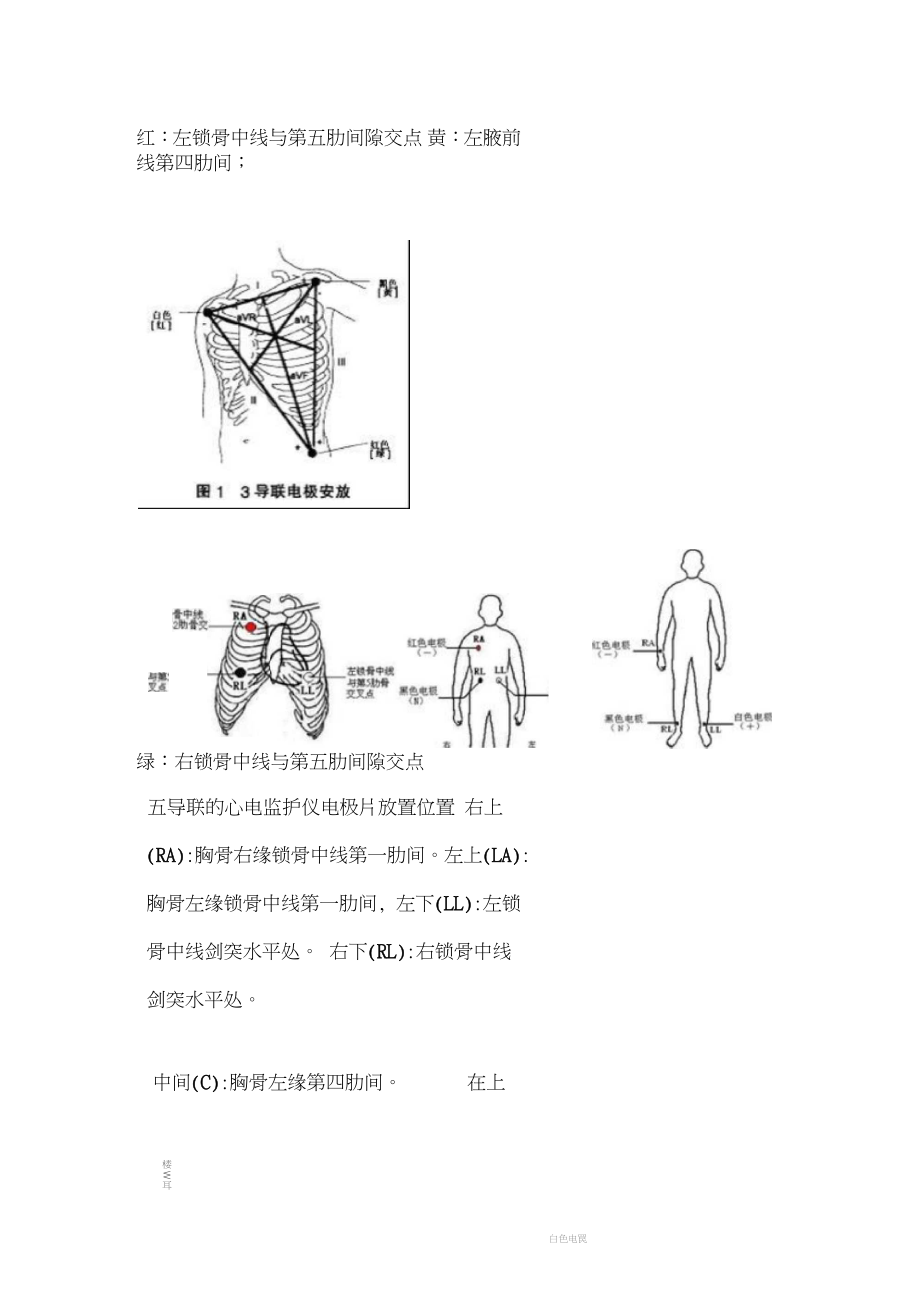 心电监护安置位置图解图片