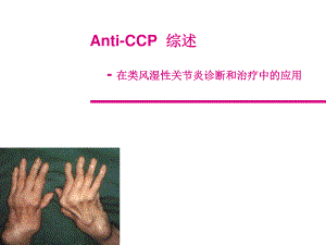 CCP抗环状胍氨酸肽抗体