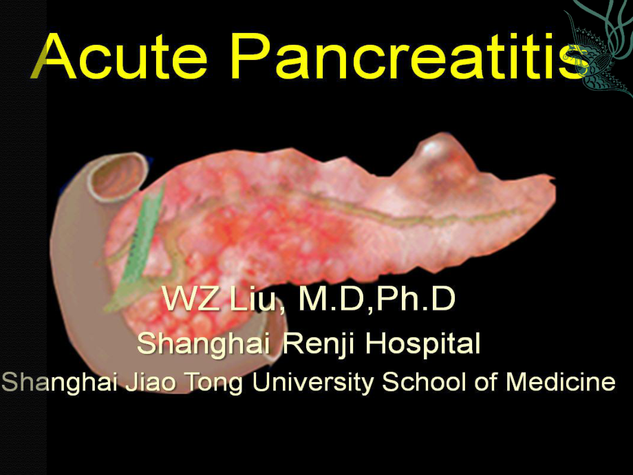 Acute Pancreatitis：急性胰腺炎_第1页