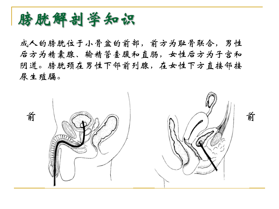 膀胱冲洗步骤图片