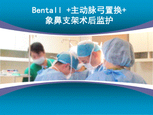 【專(zhuān)業(yè)課件】Bentall動(dòng)脈弓置換象鼻支架術(shù)后護(hù)理