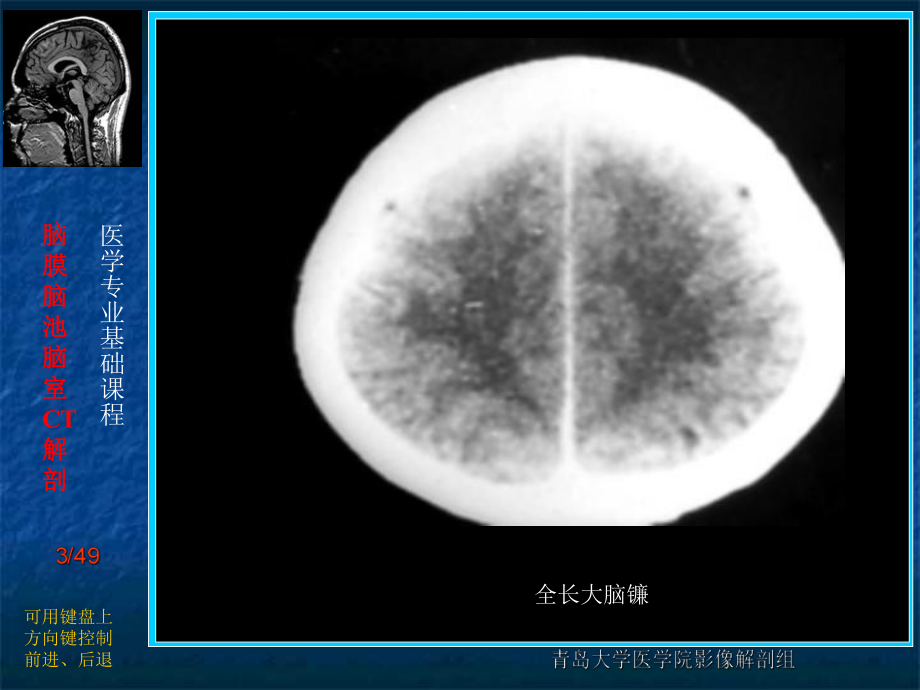 腦膜腦池腦室ct解剖ppt