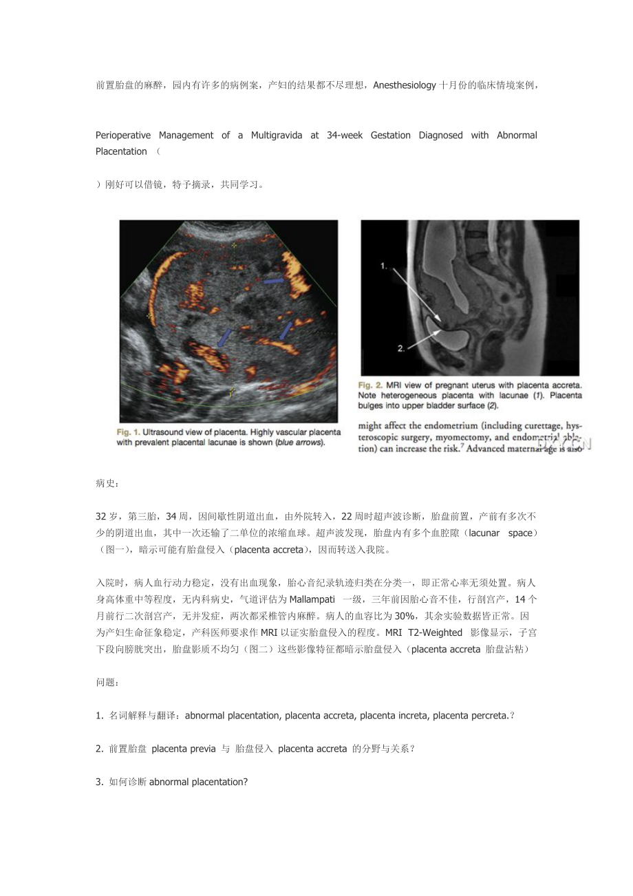 前置胎盘的麻醉_第1页