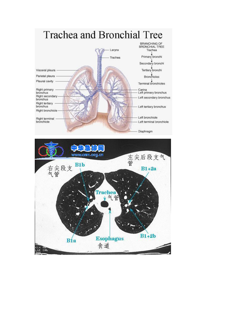 ct肺分叶分段ct实图及模拟分段图