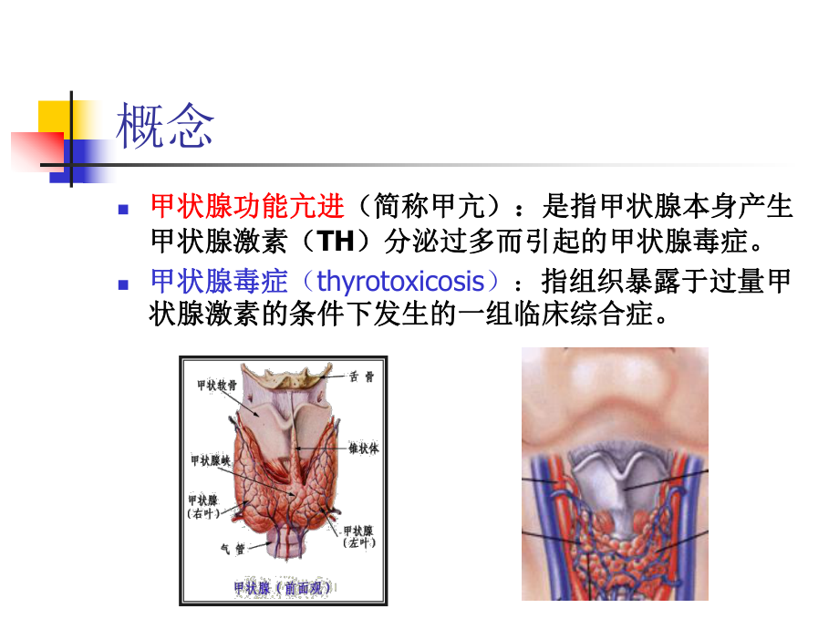 verygood甲狀腺功能亢進症