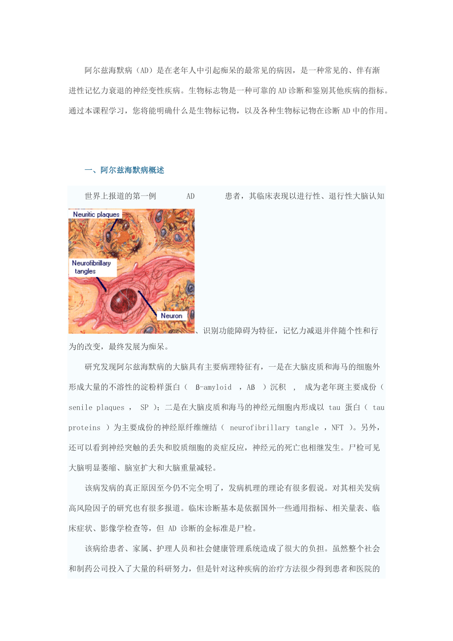 阿爾茲海默病臨床進展_第1頁