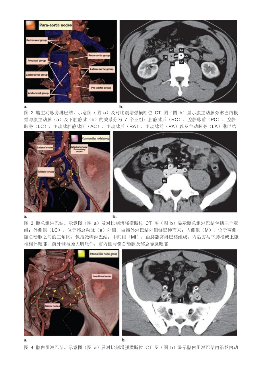 解剖圖加ct圖輕鬆掌握婦科腫瘤淋巴結轉移途徑