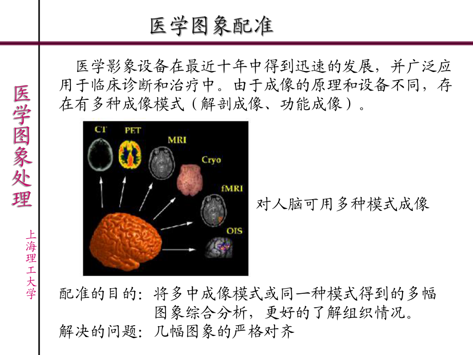 《醫(yī)學(xué)圖象處理》PPT課件_第1頁