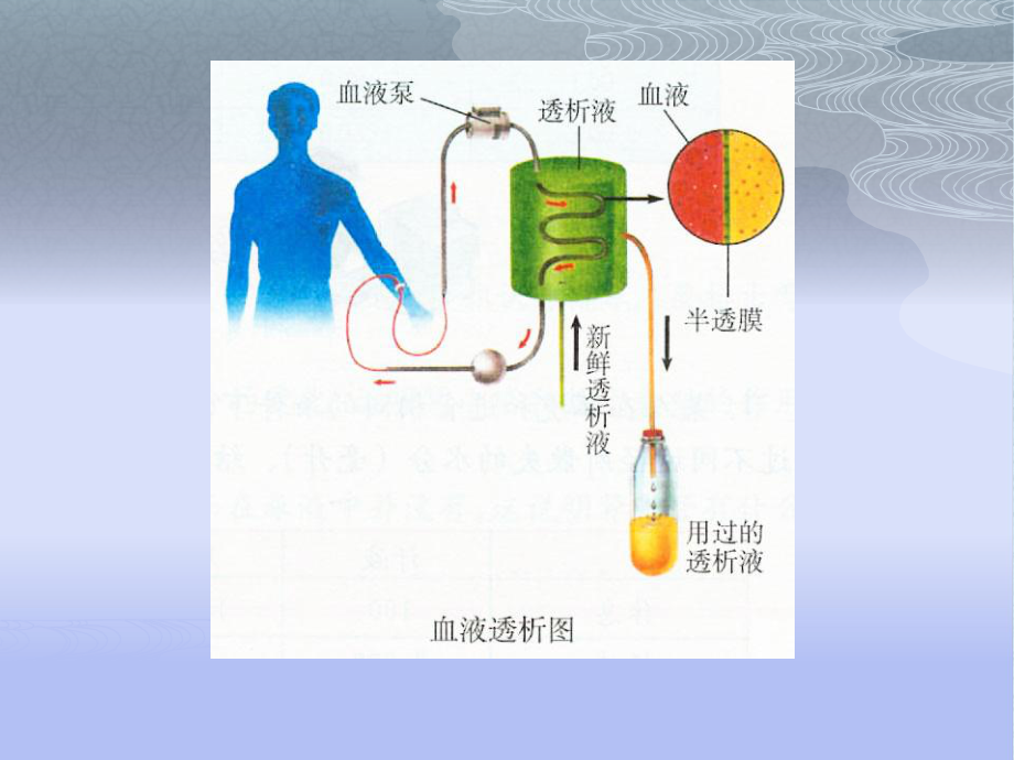 血液透析ppt