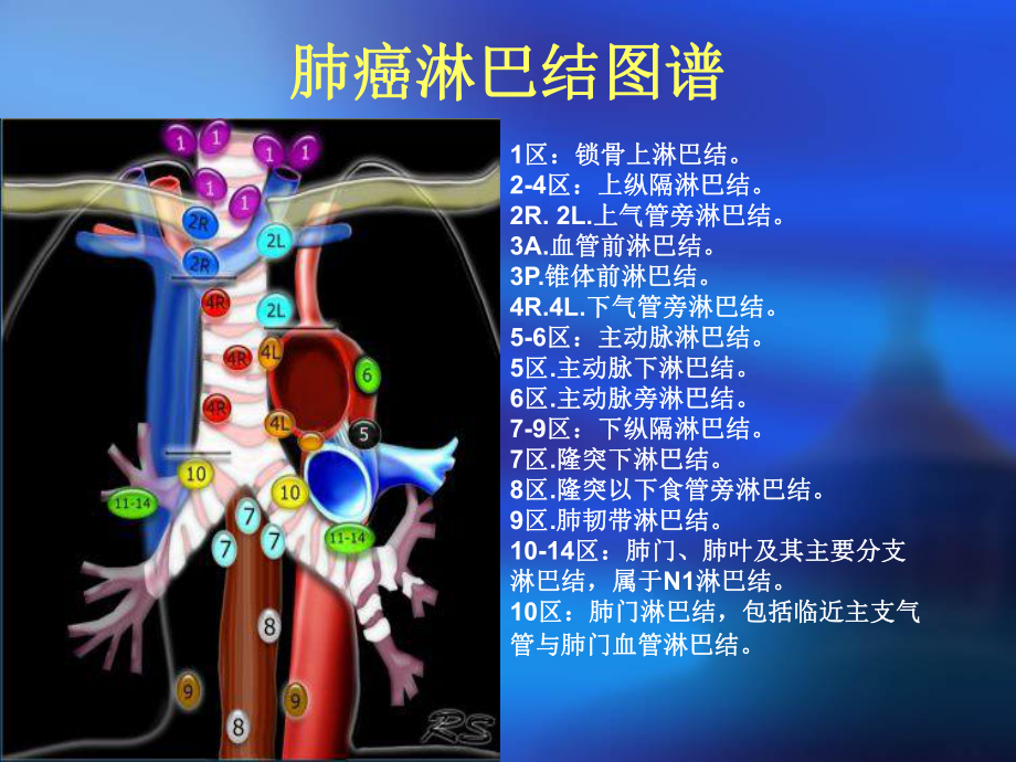 肺癌淋巴结图谱 ppt